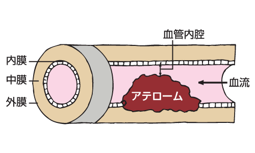 血管 拡大図